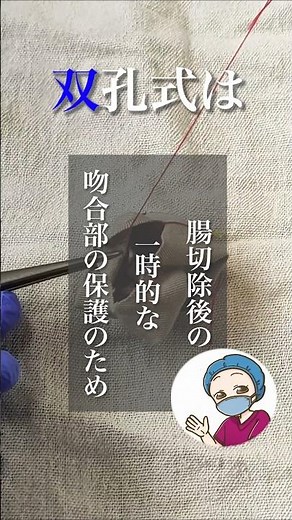 双孔式ストマと単孔式ストマの違いは？#看護師の勉強垢 人工肛門#看護師 #手術室看護師 #手術 #オペ看 #ストマ #看護師の日常