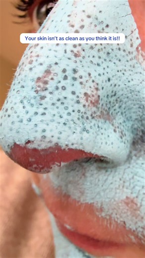 Deep Clean Your Skin with a Mud Mask