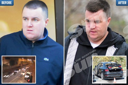 Steven 'Bonzo' Daniel's horror facial injuries after Glasgow gang murder bid