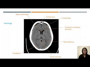 CT Head Sectional Anatomy - ARRT Registry and CQR Review