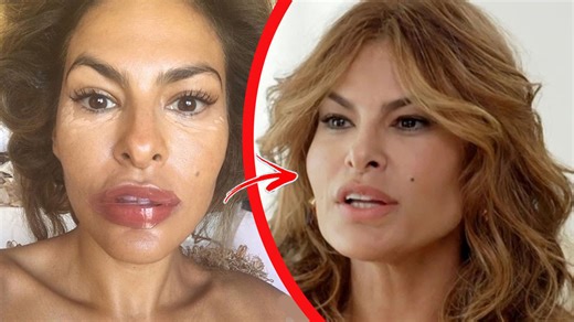 289K views · 1K reactions | 5 Botched Celebrity Surgeries That Ended Horribly | Beyond The Screen | Facebook