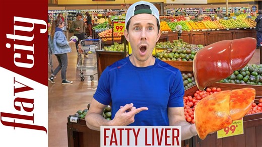 Top Foods To Reverse Fatty Liver Disease And Avoid