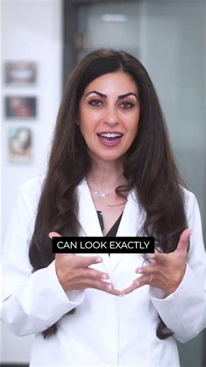 Crowns vs veneers on front teeth Dr. Yazdan | Newport Beach dentist Orange County porcelain veneers