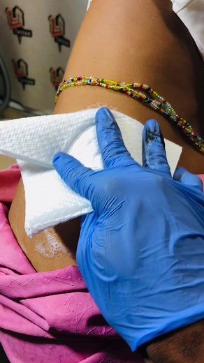 SERVIÇOS DISPONIVEIS • APLICAÇÃO DE • TATUAGENS • PIERCING NORMAL • PIERCING MICRODERMAL • MICROPIGMENTAÇÃO «LABIAL-SOMBRACELHAS» • REMOÇÃO DE TATUAGENS E MANCHAS LEVES • REMOÇÃO DE ACNES •e muito mais 🥰🥰🥰 a 9dd é que Nas segundas e nas quintas feiras tem oportunidade (promoção) limitadas de tatuagens básicas de 7.000kz fica a 5.000kz 👌60 Dias de #PROMOÇÃO 🇦🇴 🥰 Att:🇦🇴🔥 FAZ O BÁSICO SEGUE @chocolath_tattoo_official VISITE P >>> https://www.instagram.com/chocolath_tattoo_official?igsh=MW