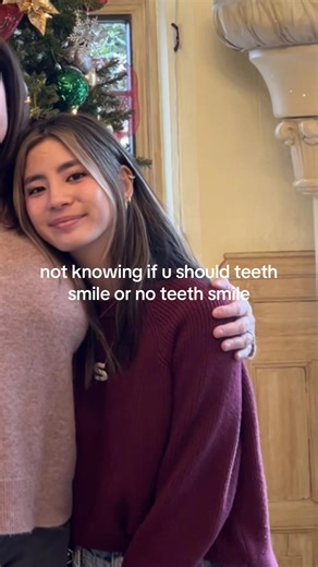 Understanding Gummy Smiles: Teeth vs. No Teeth Smiling