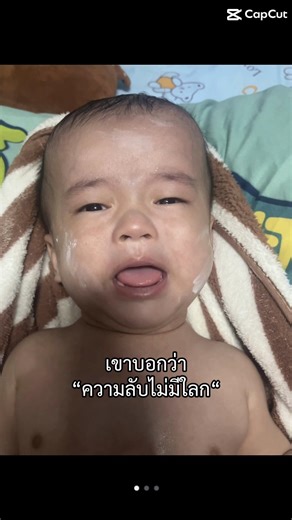 ต่อจากคลิปก่อนที่เห็นความผิดปกติที่หัวน้องหลังผ่ากลับมาบ้านได้1เดือนกว่า แม่ๆสังเกตที่หัวน้องน้องหัวโตเห็นได้ชัดแม่พากลับมาหาหมอวัดหัวดูหัวน้องโตเกินขนาดหัวปกติของเด็กจริงๆ เอ็กซเรย์ดูมีน้ำคลั่งอยู่ในหัวไม่สามารถระบายออกเองได้ หมอบอกกับแม่ว่าน้องต้องได้ผ่ารอบที่2นะแม่เพื่อใส่สายระบายไม่งั้นหัวน้องจะโตเรื่อยๆจนรักษาไม่ได้🥹😔ใจแม่สลายลูกต้องเจ็บอีกแล้วน้องกายเป็นเด็กที่ต้องรักษาตลอดไปๆมาๆบ้านกับโรงบาล😥เดะแม่จะมาอัพอาการหลังใส่สายระบายนะคะ#ขอบคุณทุกคอมเม้นต์ทุกกำลังใจค่ะ🙏🏻✌🏻 #tiktok