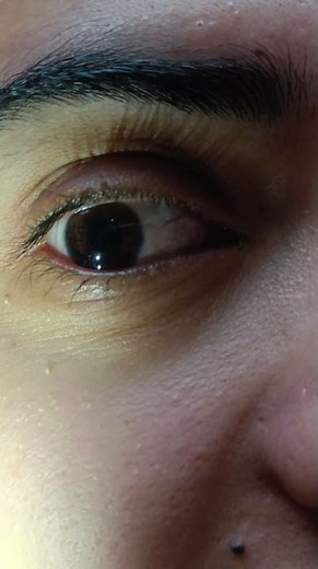 Watch Your Pupil Shrink & Grow in Seconds #science#education#STEM#learning#sciencefacts