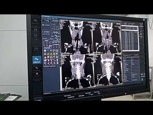Filming CT scan of Neck with Contrast. Axial, Sagittal & Coronal images