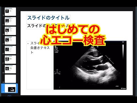 検査技師そうくさんによる、はじめてのUCG！心エコー入門！