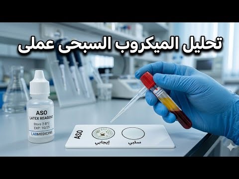 👉 ASOT Latex Test | تشخيص الحمى الروماتيزمية عملى وتفسير النتائج بشكل بسيط