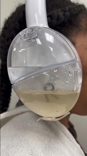 FDA-Cleared OtoSet® Ear Cleaning System - Earwax Removal Procedure