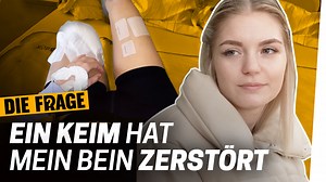 545K views · 4.8K reactions | Amputation klingt im ersten Moment nach starken Schmerzen. Für Anna war es aber genau anders herum: Vor ihrer Beinamputation hatte sie so starke Schmerzen, dass sie die Entscheidung getroffen hat, sich das Bein abnehmen zu lassen. Nachdem 33 Operationen ihr und ihrem Bein nicht helfen konnten, war die Amputation Annas beste Lösung. Wie es Anna nach der Amputation geht und ob sie mit ihrer Entscheidung glücklich ist, will Frank wissen. | Die Frage | Facebook