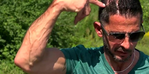 Man shot in the head at point-blank range survives, considered a ‘medical miracle’ by doctors