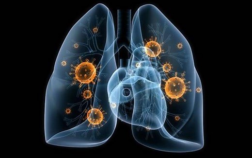 【实战代码】如何使用ARIMA模型预测世界肺炎确诊人数？【时序数据预测】