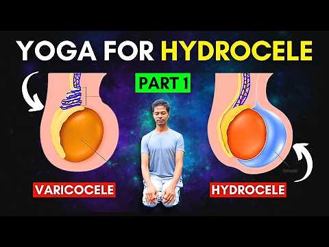 Treat Hydrocele & Varicocele at Home Part 1 | Yoga Exercises for Hydrocele & Varicocele #hydrocele