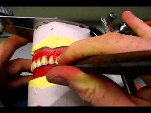 Setting upper posterior teeth