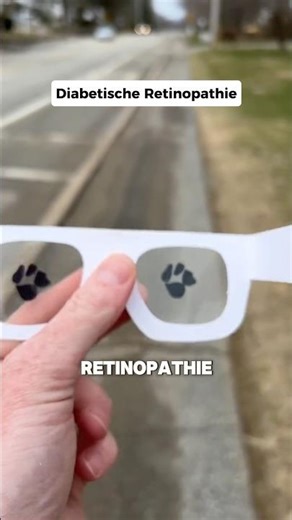 Das sehen blinde Leute wirklich 😯 #shorts