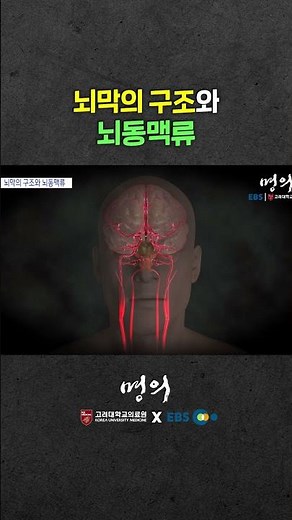 뇌동맥류는 어느 부분에 잘 생길까?
