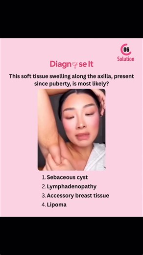 Ayush Kumar on Instagram: "Treat patient like real doctor on “Diagnose it” app History -> lab test -> diagnosis -> treatment -> clinical insight try “Diagnose it” completely free game on app and play store #doctor #medical #meds #medicalschool #mbbs #pg"