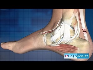 Ankle Joint Arthroscopy-Therapeutic : Ankle Arthroscopic Surgery, Examination, Treatment