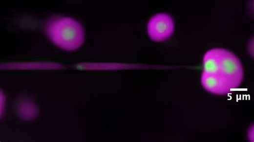 Princeton Engineering - Starting as an undergraduate project, an experiment reveals cells’ secrets