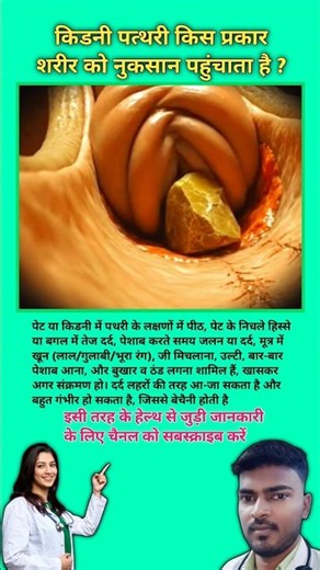 किडनी पत्थरी किस प्रकार शरीर को नुकसान पहुंचाता है ? Side effects of kidney stones || #viral