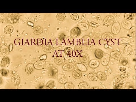 Giardia lamblia cyst under microscope at 40X.