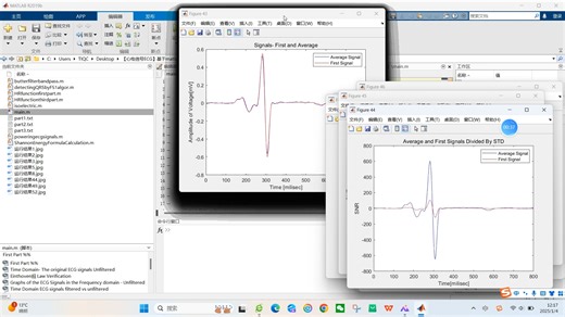 【心电信号ECG】基于matlab心电图和心音信号处理【含Matlab源码 10897期】