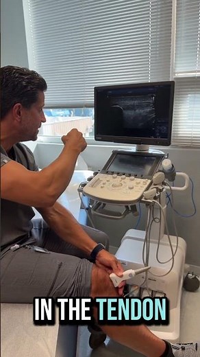 Patellar Tendon Injury Explained: Jumper’s Knee, Imaging & Recovery Tips