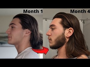 4 MONTH Minoxidil Beard Transformation | Beard Growth Results