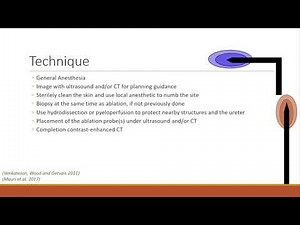 SIR-RFS Webinar: Renal Ablation