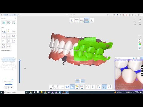 Medit i700W Scanning Techniques