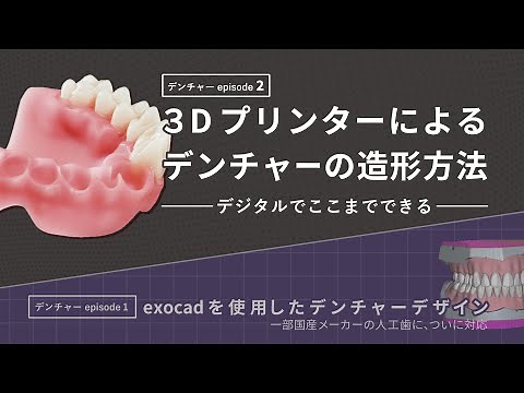 3Dプリンターによるデンチャーとテックの造形方法 『フルデジタルデンチャー』の作成が実現！