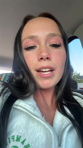 Tanning Bed Mishap: My Face Burn Experience