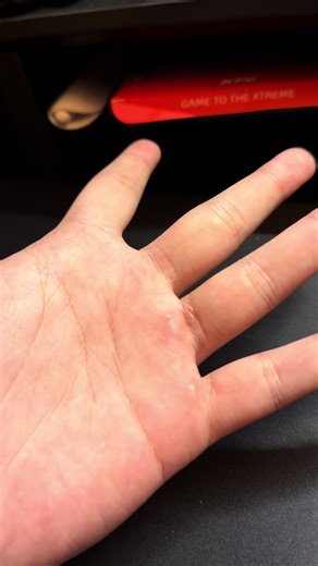 Siapa nih yg suka bibirnya pecah