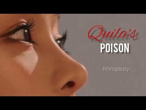°☆ Did you get a rhinoplasty? | rhinoplasty subliminal