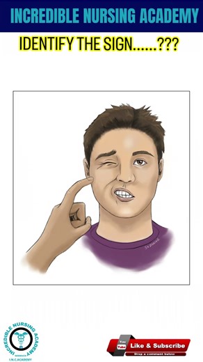 Identify the Condition...... Both sign are seen in .......????? #norcet #nursing #nurse #fundamental