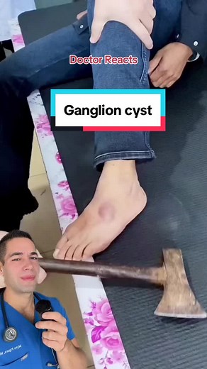 Ganglion cysts often come back #ganglioncyst #doctor #pop | cyst