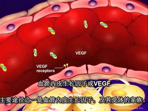 肿瘤生物学4：血管生成