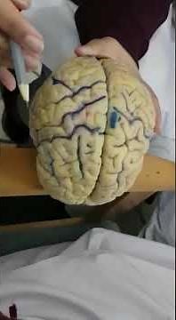 Anatomy of Brain 1 |MBBS|USMLE|PLAB|AMC