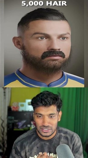 1 Hair to 60,000 Hair