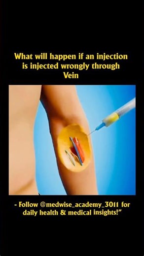⚠️ 😳Wrong IV Injection Can Be Dangerous! #ivinjection #veins