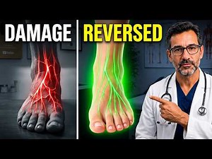 How To Treat Feet Soles Tingling or Numbness, Must Watch To Treat, Reversed & Care The Damage Nerves