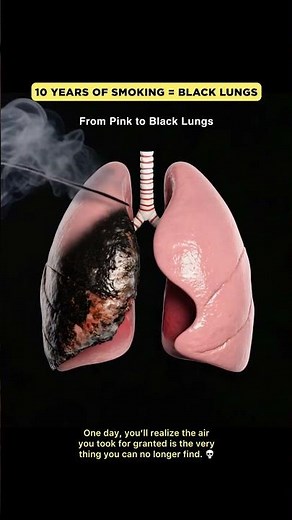 This Is What 10 Years of Smoking Does to Your Lungs 🚬🫁