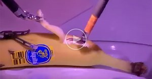 Doctor in London Performs Remote Surgery on Banana in California