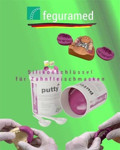 Fegura Sil putty: Anwendungen im Schnellüberblick