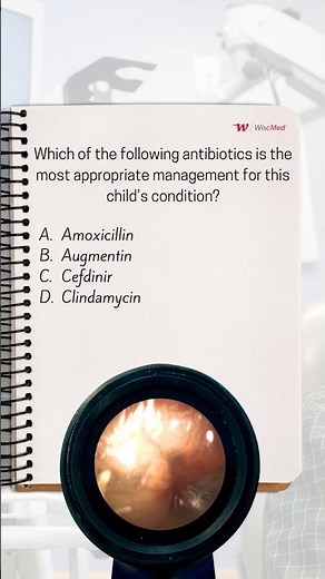 3-Year-Old with Ear Pain and Fever