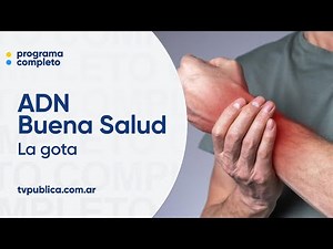 Gota: causas, síntomas y claves para su prevención - ADN Buena Salud