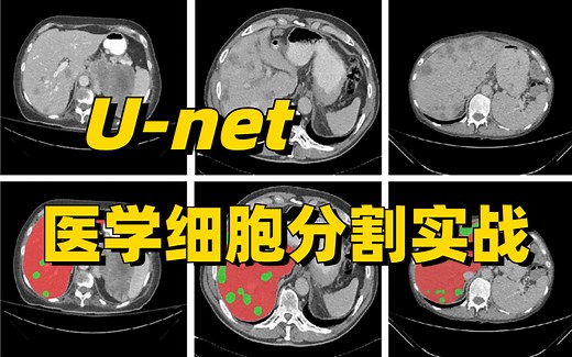 用OneFlow和U-net实现基于U型网络的ISBI医学细胞分割任务！图像分割中的深度学习:U-Net 体系结构!人工智能/深度学习/神经网络/机器学习/AI