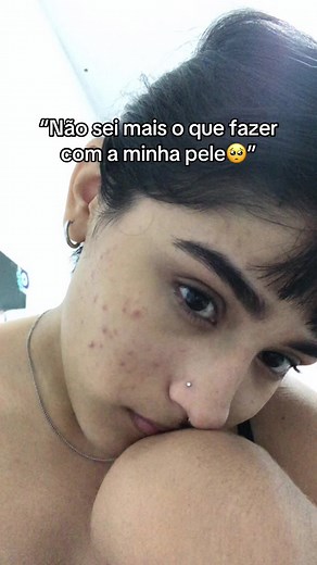 Mais um vídeo do Acnezil porque nunca é demais falar de um produto bom, né?💋💋